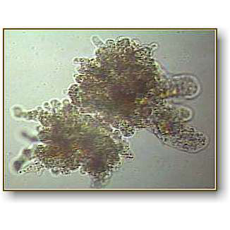 Amoeba Proteus | Microbus Microscope Educational Website